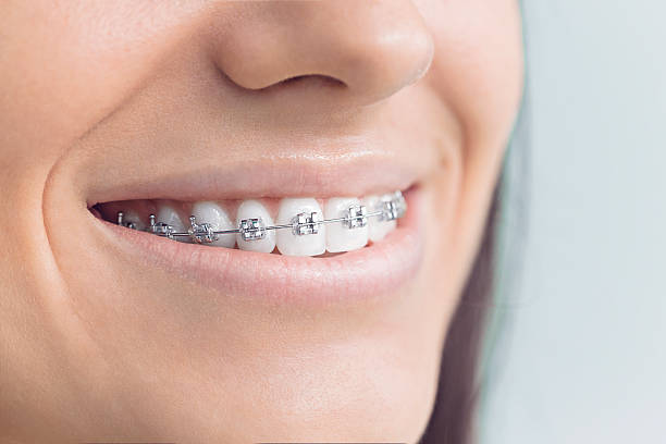 Best Full Mouth Reconstruction  in Springdale, NJ